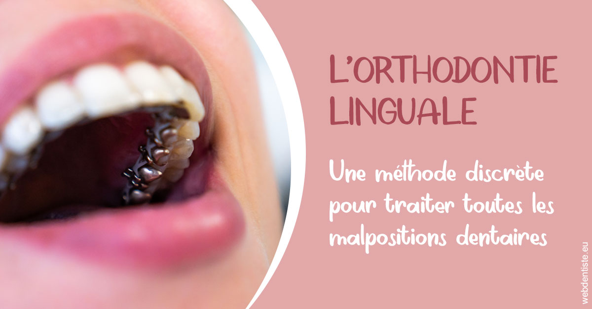 https://selarl-olivier-demonceaux.chirurgiens-dentistes.fr/L'orthodontie linguale 2