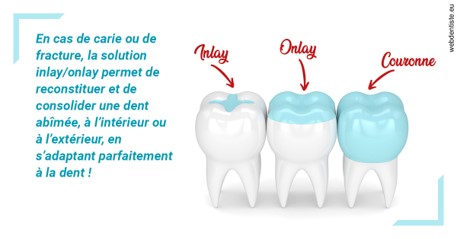 https://selarl-olivier-demonceaux.chirurgiens-dentistes.fr/L'INLAY ou l'ONLAY