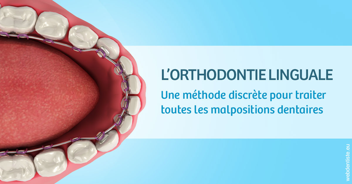 https://selarl-olivier-demonceaux.chirurgiens-dentistes.fr/L'orthodontie linguale 1