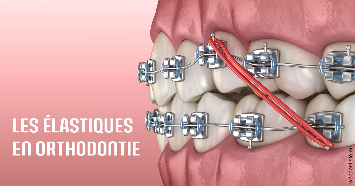 https://selarl-olivier-demonceaux.chirurgiens-dentistes.fr/Elastiques orthodontie 2