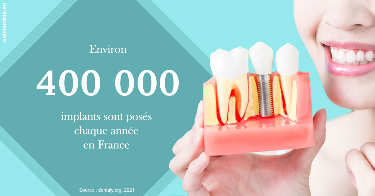 https://selarl-olivier-demonceaux.chirurgiens-dentistes.fr/Pose d'implants en France 2