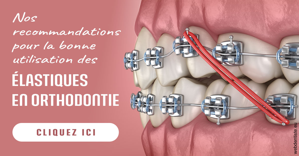 https://selarl-olivier-demonceaux.chirurgiens-dentistes.fr/Elastiques orthodontie 2
